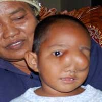 Kelainan Sejak Lahir, Bocah 2 Tahun Mengaku Nyeri Tiap Hari