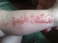 Massa Berdatangan, Baju Ali Jadi Rebutan