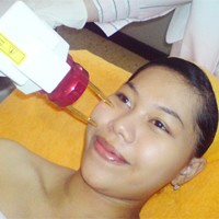 Dapatkan Kulit Kenyal dengan Fracs Laser