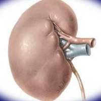 Pernefri Tularkan Teknik Terbaru Hemodialisis