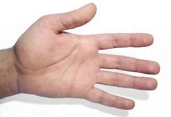 Pesan Misterius Ungkap Penyakit Aneh Akromegali