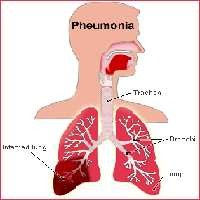 Pembunuh Balita yang Terlupakan