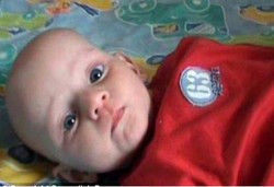 Pneumonia, Pembunuh Balita yang Terlupakan