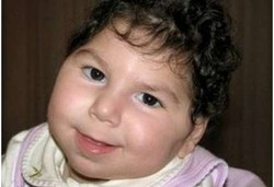 Obat Ajaib Sembuhkan Bayi Australia dari Kelainan Otak Langka