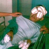 Abda Bisa Dijerat Hukum Pidana dan UU Bahan Peledak