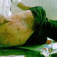 Polisi Minta Keterangan 6 Orang Saksi Mata