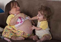 Ibu Terkecil di Dunia Nekat Melahirkan