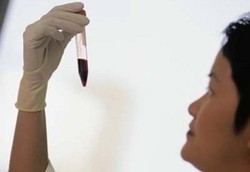 Mengukur Kadar Kolesterol Lebih Mudah