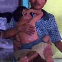 Aneh, Bocah 3 Tahun Miliki Kebiasaan Makan Beras Mentah