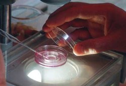 Dokter di AS Tak Pakai Sperma Suami untuk Pasien Bayi Tabung