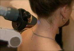 Terapi Laser Efektif Obati Sakit Leher