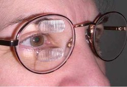 Menyetir Berbahaya Bagi Penderita Hemianopia