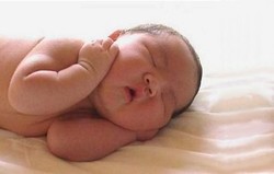 Hipotiroidisme Neonatal