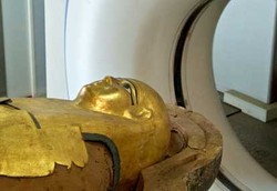 Penyakit Jantung Ditemukan Pada Mumi