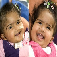 Trishna Sadar dari Koma