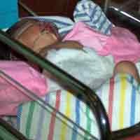 Seorang Bayi di Probolinggo Lahir dengan Usus Terburai