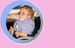 Osteogenesis Imperfecta