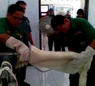 Melihat Produksi Anggota Tubuh Palsu