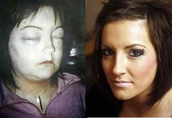 Alergi Parah Setelah Mewarnai Rambut