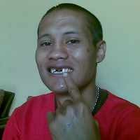 Alwi Lempar Giginya ke Pelaku