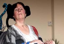 Penderita LIS, Hidup di Dalam Tubuh yang Terkunci