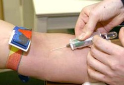 Menata Kolesterol, Mencegah Stroke