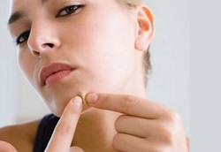 Jerawat Tak Bisa Diobati Secara Kilat