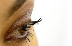 Oklusi Arteri Retina