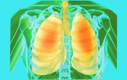 Paru-paru Rheumatoid