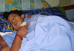 Bocah Kanker Tulang Ingin Hidup di Tengah Tipisnya Harapan