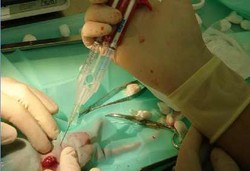 Australia Bolehkan Transplantasi Organ Hewan ke Manusia