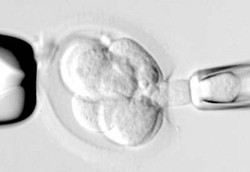 Teknik Memilih Jenis Kelamin Anak
