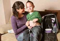 Derita Bocah yang Tak Pernah Bisa Makan Lewat Mulutnya