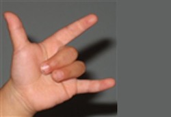 Badung di Waktu Kecil Bikin Cepat Tutup Usia