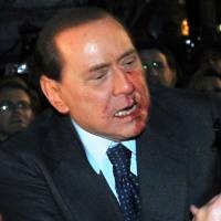 Diserang Orang, Berlusconi Babak Belur