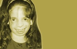 Treacher-Collins Syndrome (TCS)