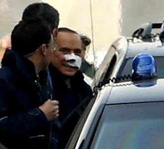 Berbalut Perban Berlusconi Tinggalkan RS