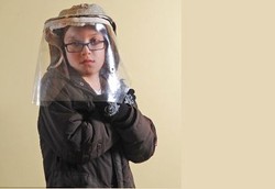 Sinar Matahari Membakar Kulit Bocah Penderita XP