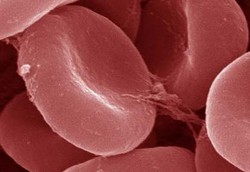 Sel Darah Merah Buatan Bantu Pasien Kelainan Darah