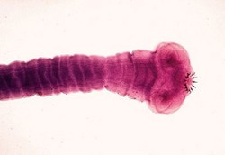  Cacing Pita yang Memakan Otak Manusia