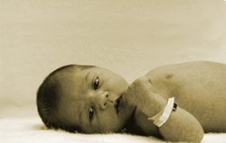  Total Anomalous Pulmonary Venous Return (TAPVR)