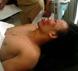 Korban Luka Dirawat di RSUD Tarakan