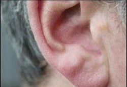 Telinga Bagian Dalam Pengaruhi Keseimbangan