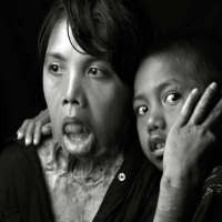 Kisah Santi yang Dibakar Suaminya