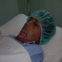 Dagu dan Leher Santy Mulai Dioperasi