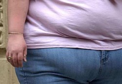 Tidak Ada Orang Gemuk yang Sehat