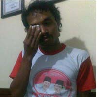 Kalah Rebutan PSK, Pria Hidung Belang Lempar Botol