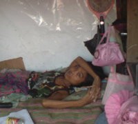 Kisah Rasnawati dengan Tumor di Tubuhnya