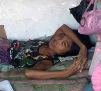 Kisah Rasnawati, Penderita Tumor