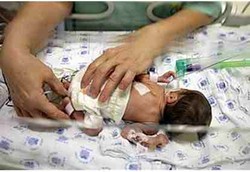 Musik Mozart Bantu Naikkan Berat Badan Bayi Prematur